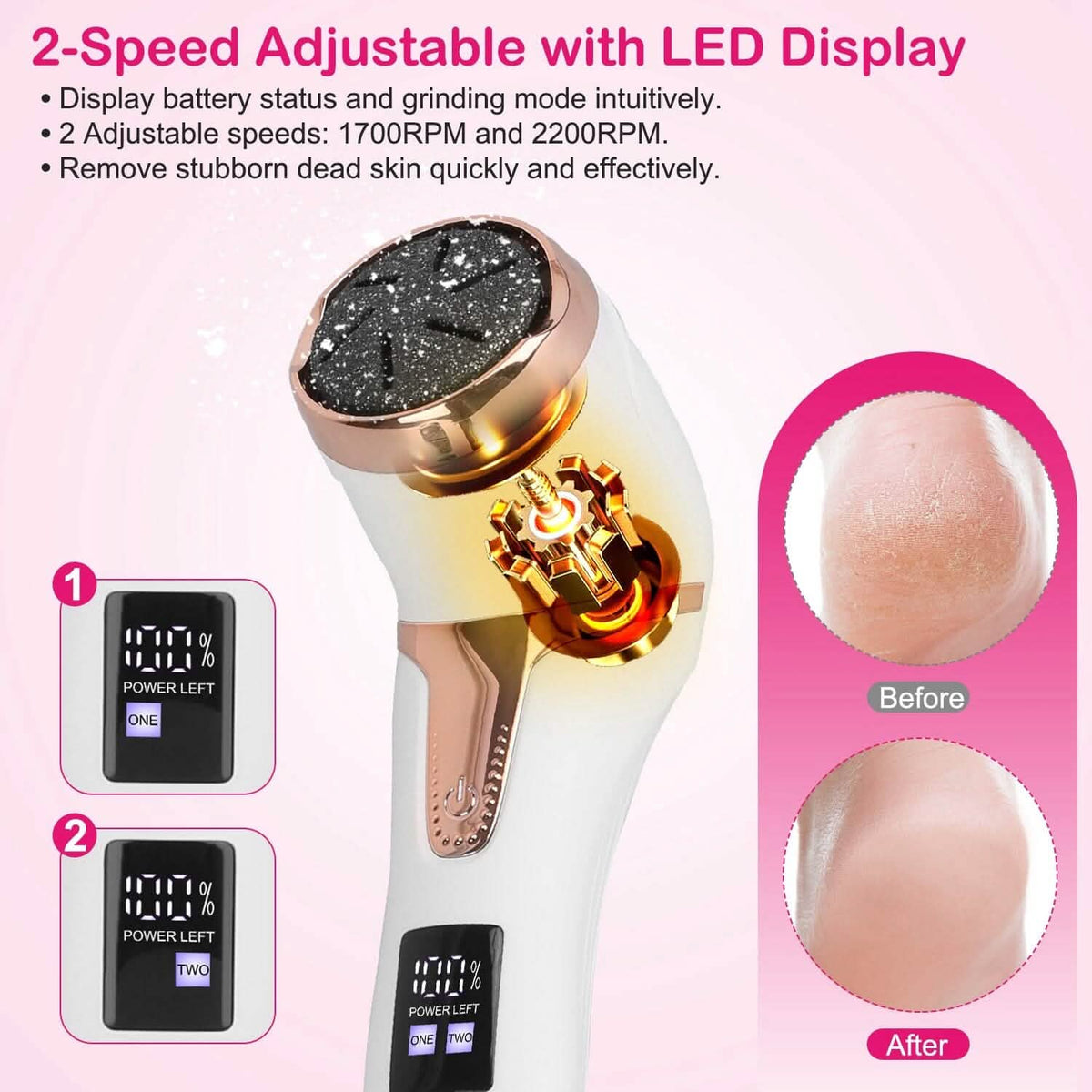 17-Pieces Set: Electric Foot Callus Remover with Vacuum Foot Grinder Rechargeable - A-1 Thread Vault