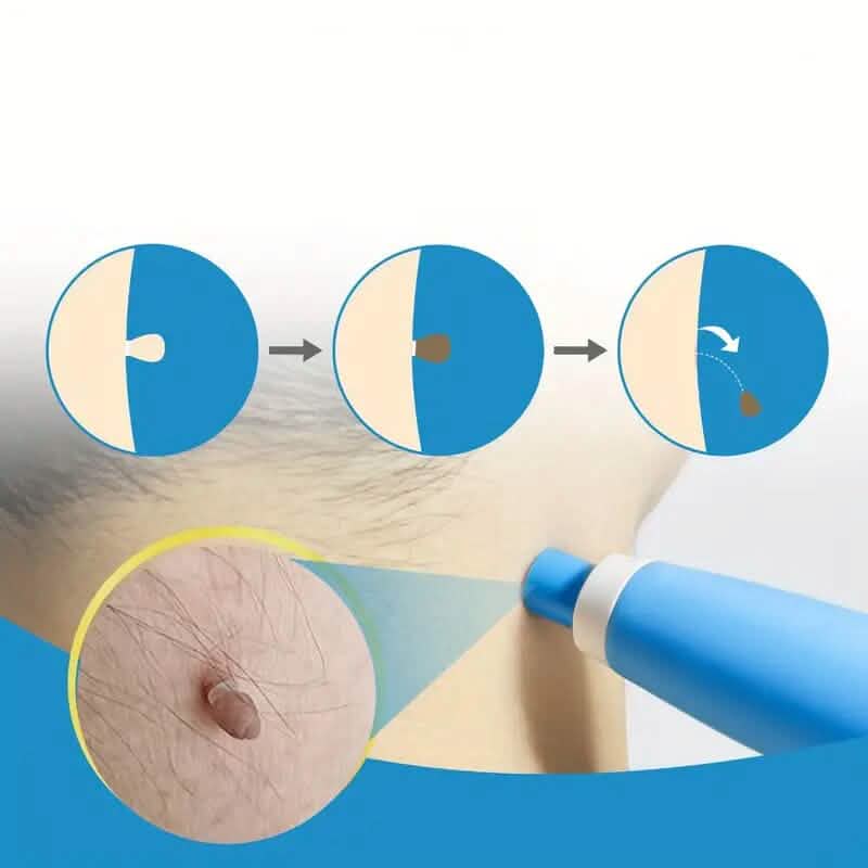 Advanced Auto Skin Tag Repair Kit - A-1 Thread Vault