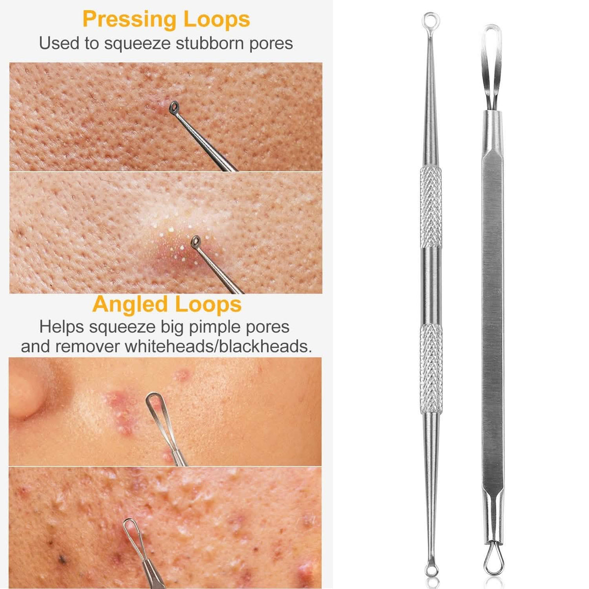 5-Piece Set: Blackhead Remover Kit Stainless Steel Popping Zit Remover - A-1 Thread Vault