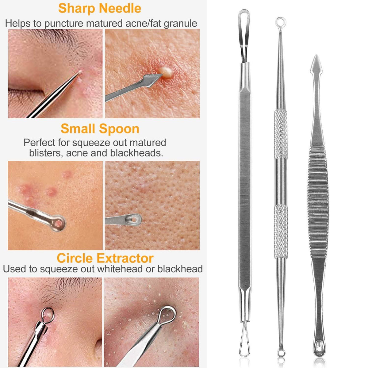 5-Piece Set: Blackhead Remover Kit Stainless Steel Popping Zit Remover - A-1 Thread Vault
