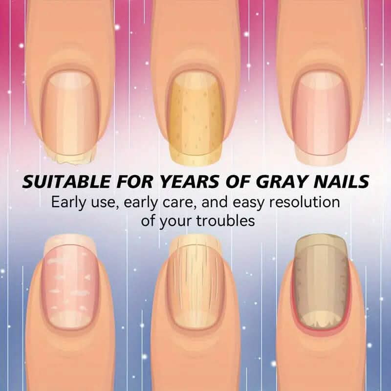 64-Pieces: Extra Strength Toenail Treatment Nail Repair Patches - A-1 Thread Vault