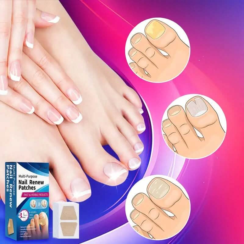 64-Pieces: Extra Strength Toenail Treatment Nail Repair Patches - A-1 Thread Vault