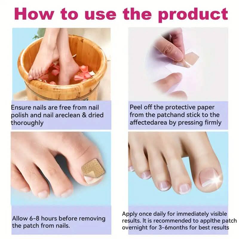 64-Pieces: Extra Strength Toenail Treatment Nail Repair Patches - A-1 Thread Vault