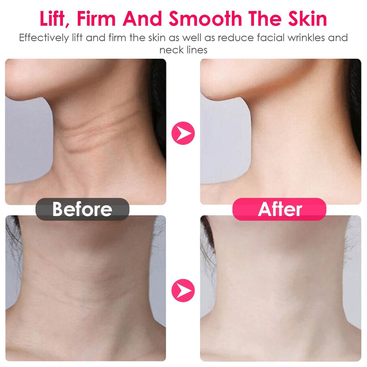 Anti Wrinkles Face Neck Massager Double Chin Reducer - A-1 Thread Vault