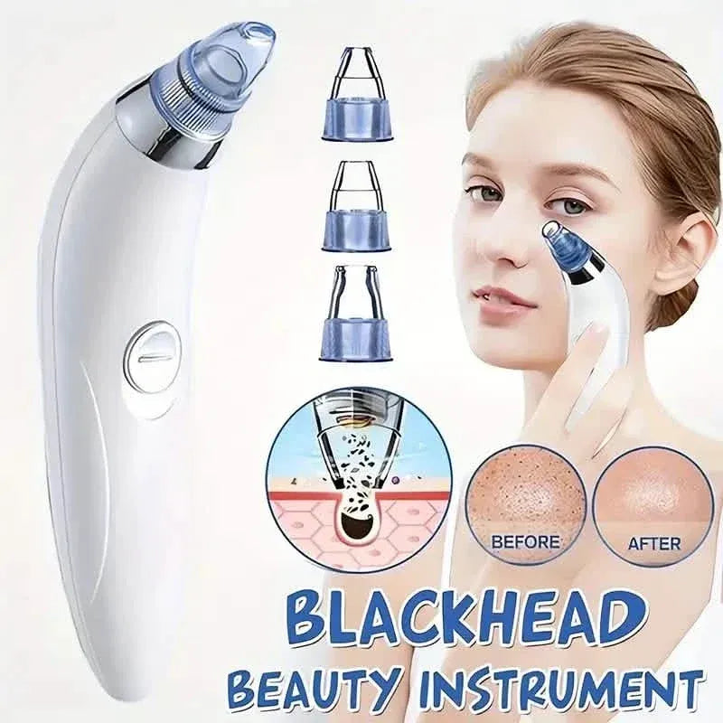 Blackhead Vacuum Remover, Powerful Portable Facial Pore Cleaner With 4 Probes - A-1 Thread Vault