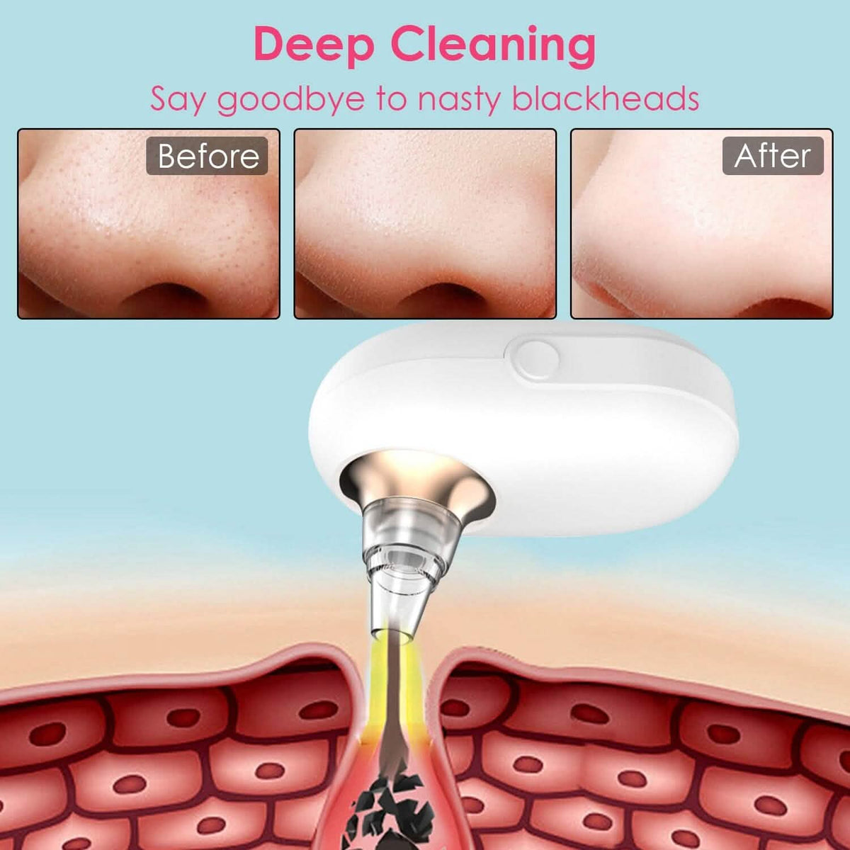 Electric Blackhead Comedone Extractor Tool Facial Pore Cleaner - A-1 Thread Vault