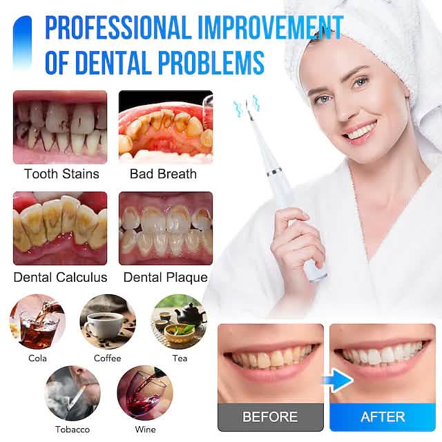 Electric Toothbrush Sonic Dental Scaler Teeth Whitening Kit - A-1 Thread Vault