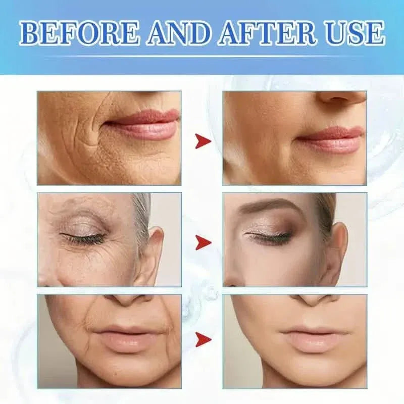Intensive Anti Aging Botox Facial Serum - Collagen Serum For Skin With Vitamin C, Hyaluronic Acid and Niacinamide - A-1 Thread Vault