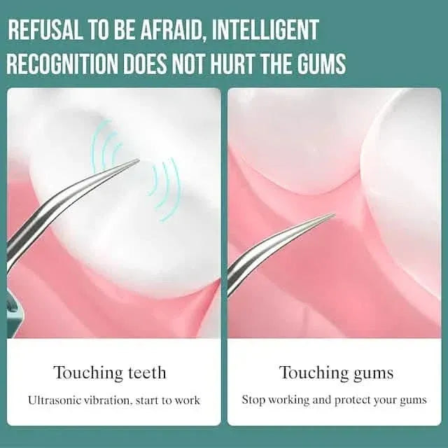 Visual Ultrasonic Teeth Cleaner - A-1 Thread Vault