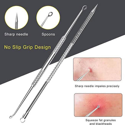 10-Piece: Blackhead Remover Tool - A-1 Thread Vault