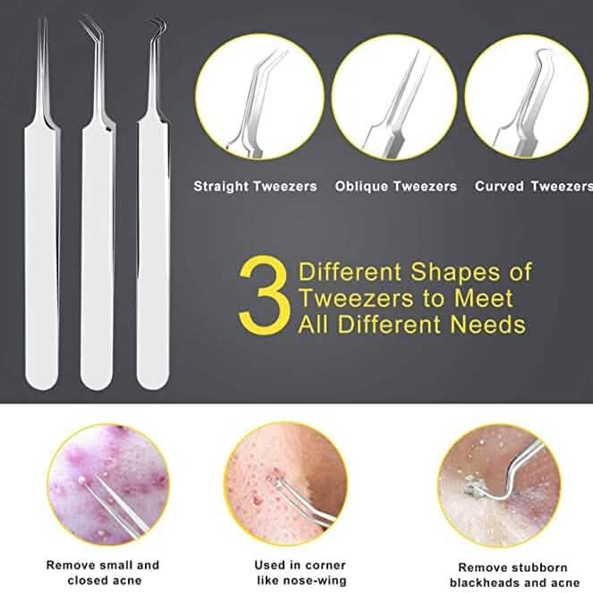 10-Piece: Blackhead Remover Tool - A-1 Thread Vault