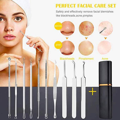 10-Piece: Blackhead Remover Tool - A-1 Thread Vault