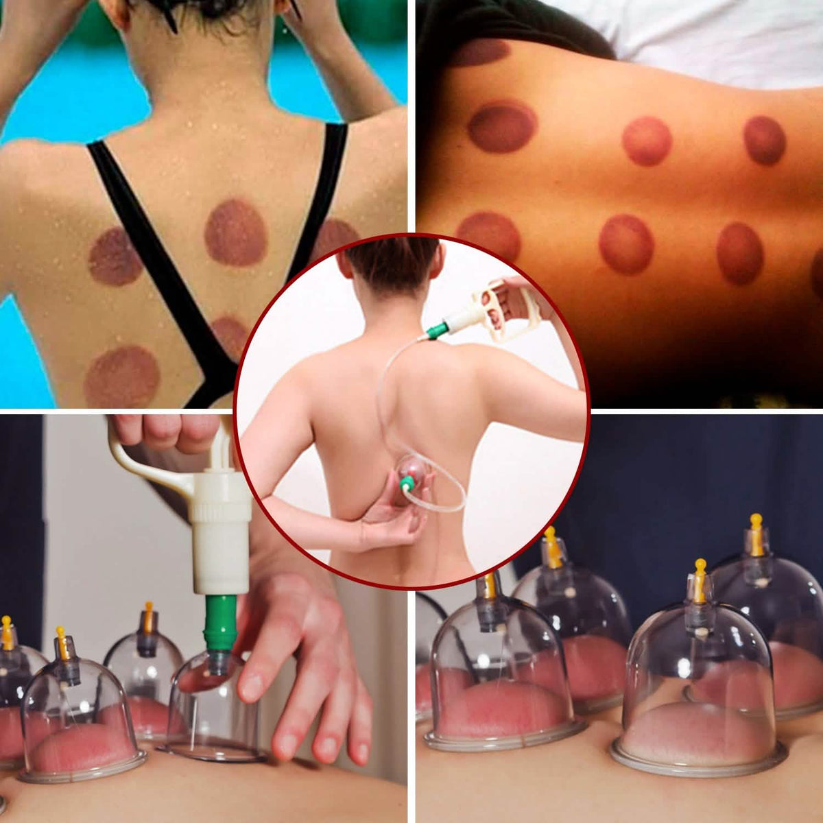 32 Cups Chinese Therapy Set - A-1 Thread Vault