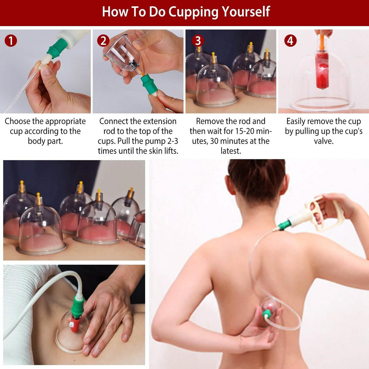 32 Cups Chinese Therapy Set - A-1 Thread Vault