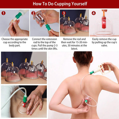 32 Cups Chinese Therapy Set - A-1 Thread Vault