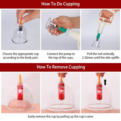 32 Cups Chinese Therapy Set - A-1 Thread Vault