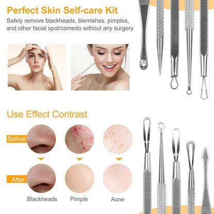 5-Piece Set: Blackhead Remover Kit Stainless Steel Popping Zit Remover - A-1 Thread Vault