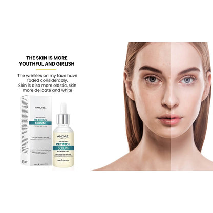 Amore Paris 2.5% Retinol Serum For Face With Hyaluronic Acid Night Facial Serum - A-1 Thread Vault