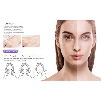 Amore Paris Niacinamide Face Serum 12% Plus Zinc 2%, Hyaluronic Acid & Vitamin E, Dark Spot Remover, Pore Minimizer & Aging Skin Treatment - A-1 Thread Vault