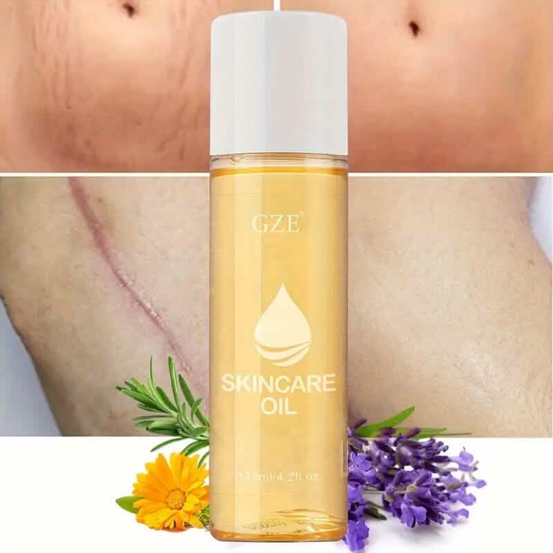 Advanced Stretch Mark Oil with Vitamin E - A-1 Thread Vault