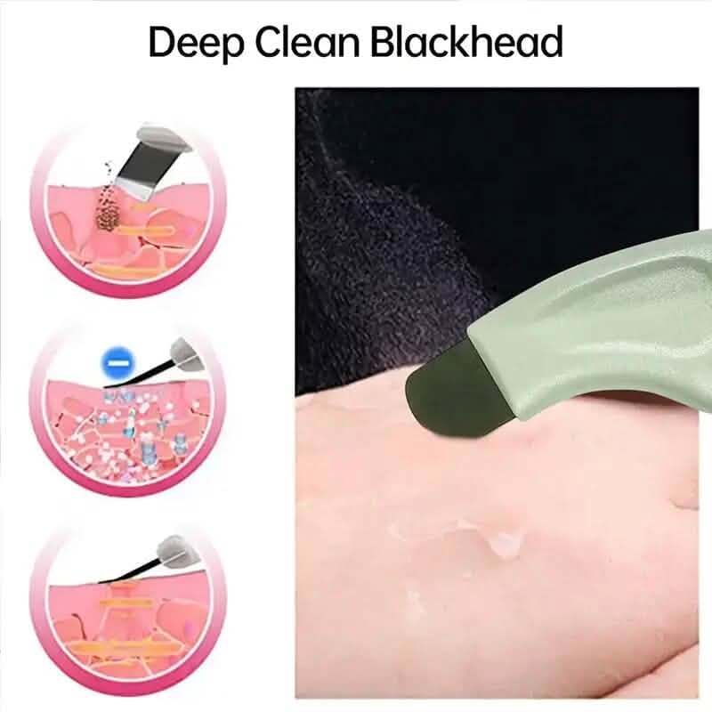 Blackhead Remover Tool Extractor - A-1 Thread Vault