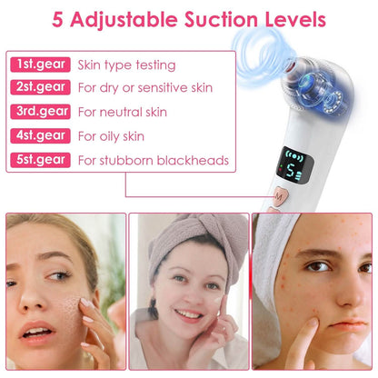 Blackhead Vacuum Remover Electric Blackhead Comedone Extractor - A-1 Thread Vault