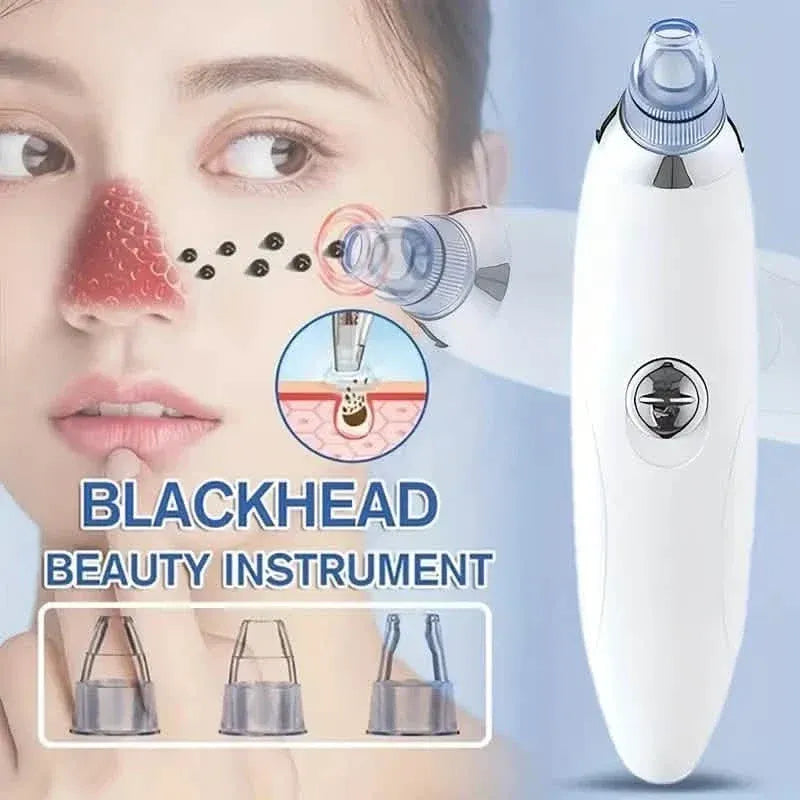 Blackhead Vacuum Remover, Powerful Portable Facial Pore Cleaner With 4 Probes - A-1 Thread Vault