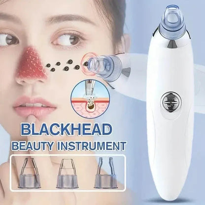 Blackhead Vacuum Remover, Powerful Portable Facial Pore Cleaner With 4 Probes - A-1 Thread Vault