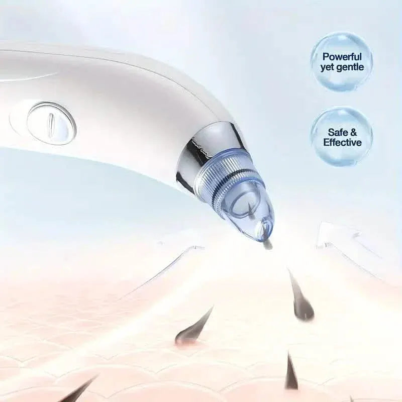 Blackhead Vacuum Remover, Powerful Portable Facial Pore Cleaner With 4 Probes - A-1 Thread Vault