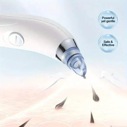 Blackhead Vacuum Remover, Powerful Portable Facial Pore Cleaner With 4 Probes - A-1 Thread Vault