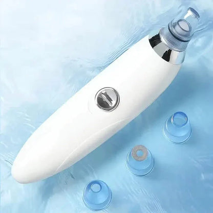 Blackhead Vacuum Remover, Powerful Portable Facial Pore Cleaner With 4 Probes - A-1 Thread Vault