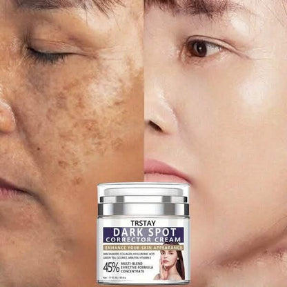 Dark Spot Corrector Cream Eliminates Dark Spots, Fades Dark Spots - A-1 Thread Vault