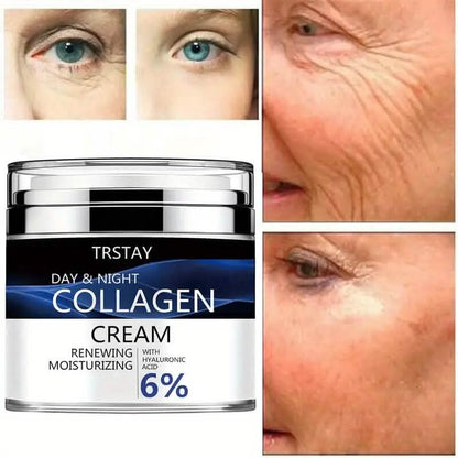 Day and Night Hydrating Collagen Cream with Hyaluronic Acid - A-1 Thread Vault