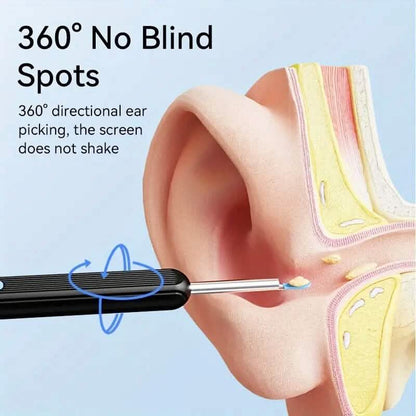 Ear Wax Removal Kit with Camera, Light and 6 Ear Spoons - A-1 Thread Vault