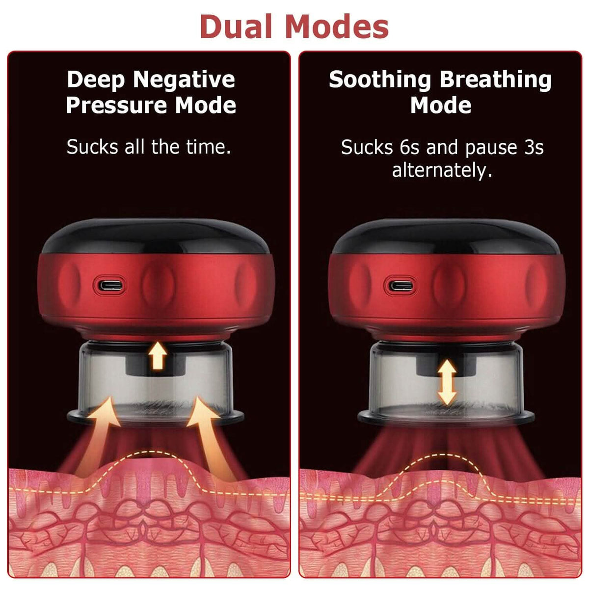 Electric Back Scraping Machine Vacuum Therapy Cupping Device - A-1 Thread Vault
