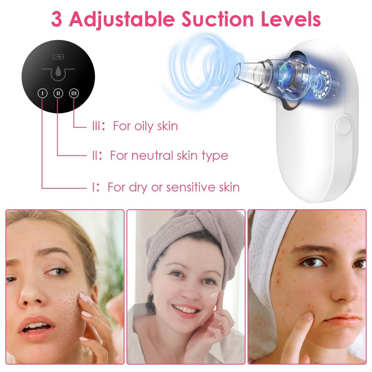 Electric Blackhead Comedone Extractor Tool Facial Pore Cleaner - A-1 Thread Vault