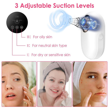 Electric Blackhead Comedone Extractor Tool Facial Pore Cleaner - A-1 Thread Vault
