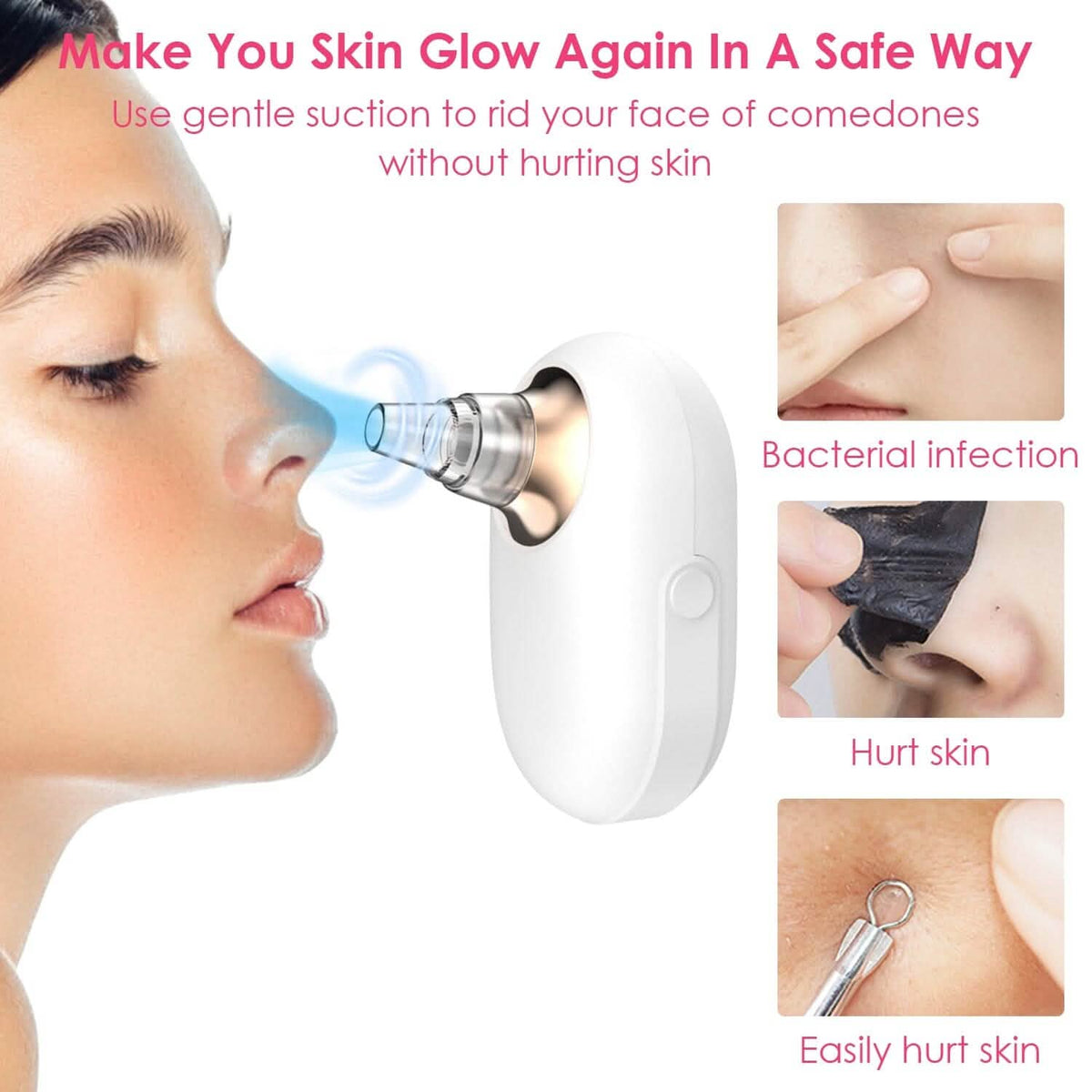 Electric Blackhead Comedone Extractor Tool Facial Pore Cleaner - A-1 Thread Vault
