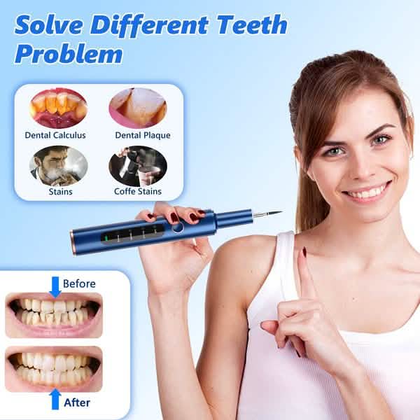 Electric Plaque Remover for Teeth, Rechargeable Teeth Cleaning Kit with 4 Modes - A-1 Thread Vault