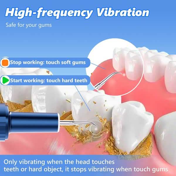 Electric Plaque Remover for Teeth, Rechargeable Teeth Cleaning Kit with 4 Modes - A-1 Thread Vault
