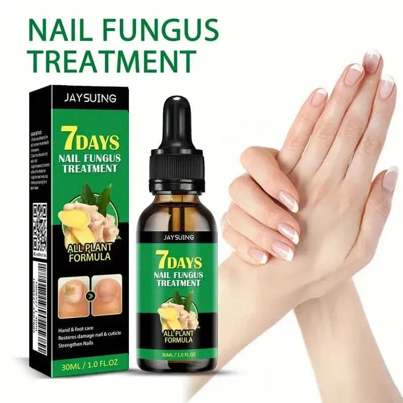 Ginger Nail Care Liquid Onychomycosis Fungus Repair Hand and Foot Nail Care - A-1 Thread Vault