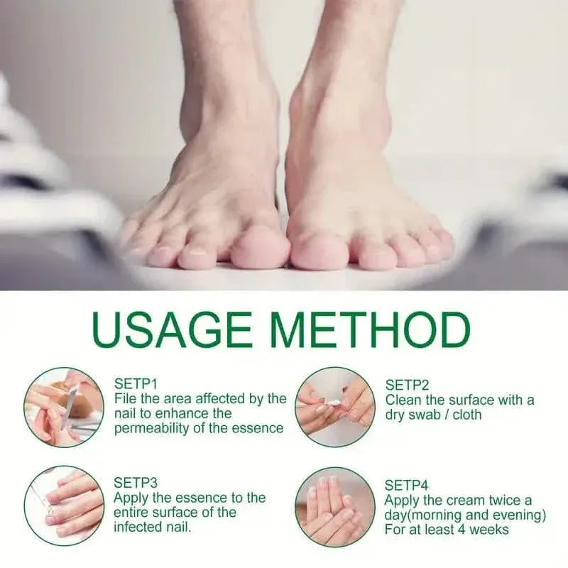 Ginger Nail Care Liquid Onychomycosis Fungus Repair Hand and Foot Nail Care - A-1 Thread Vault