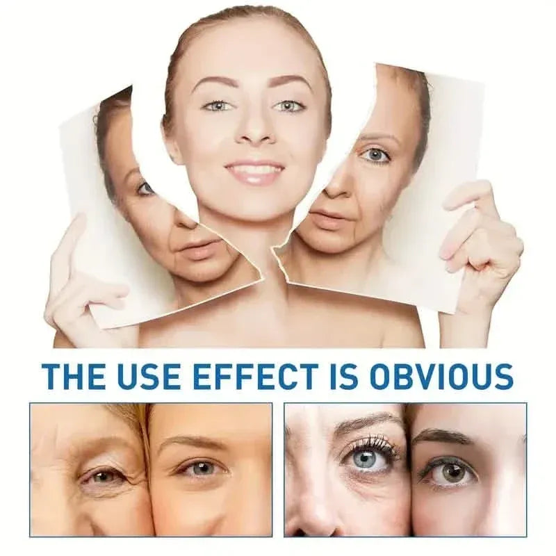 Intensive Anti Aging Botox Facial Serum - Collagen Serum For Skin With Vitamin C, Hyaluronic Acid and Niacinamide - A-1 Thread Vault