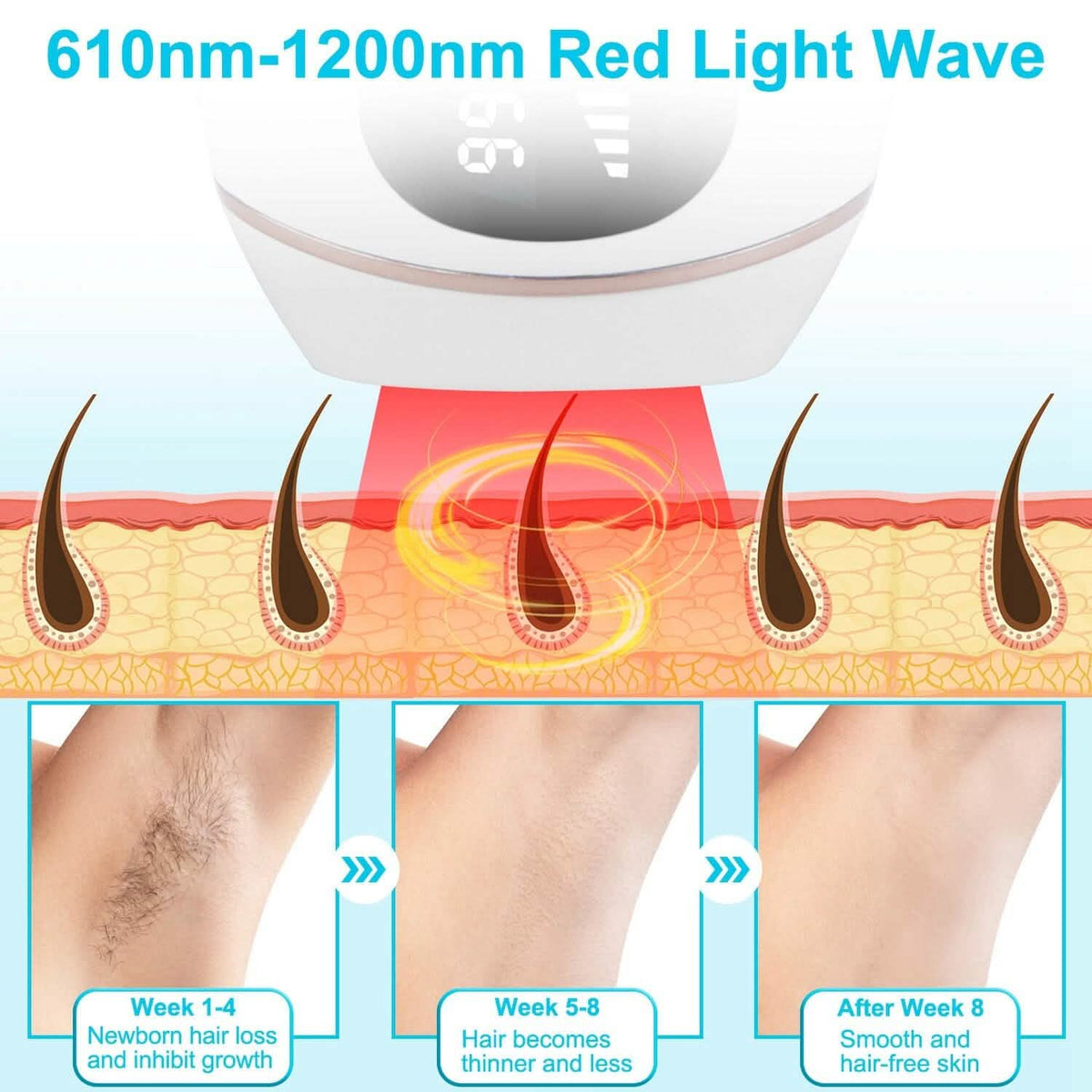 Laser Hair Removal Ice Cooling Permanent IPL - A-1 Thread Vault