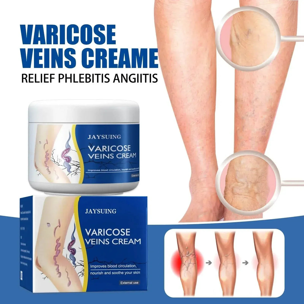 Pain Relief Leg Spider Veins Vasculitis Promote Circulation Smooth Metabolism 30g Exfoliation - A-1 Thread Vault