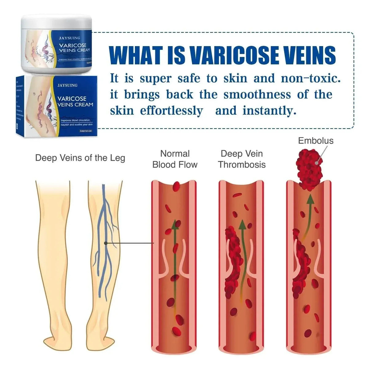Pain Relief Leg Spider Veins Vasculitis Promote Circulation Smooth Metabolism 30g Exfoliation - A-1 Thread Vault
