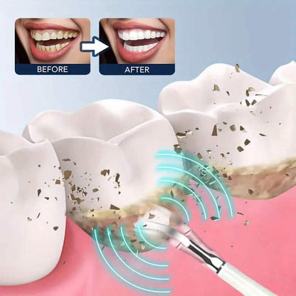 ProClean Electric Teeth Whitening Tool Set - A-1 Thread Vault
