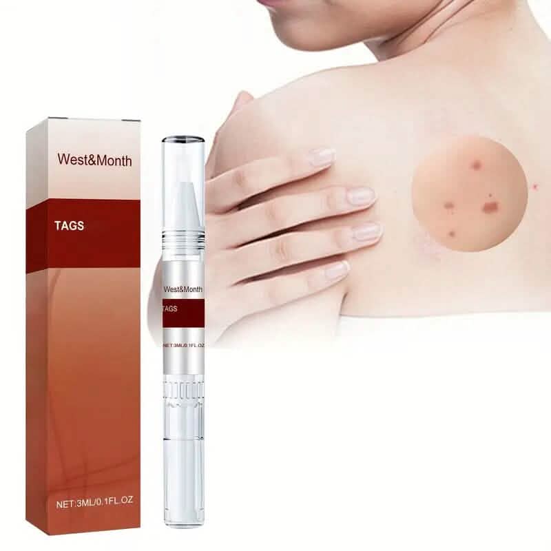 Skin Tag Removal Pen - A-1 Thread Vault