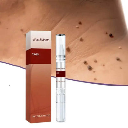 Skin Tag Removal Pen - A-1 Thread Vault