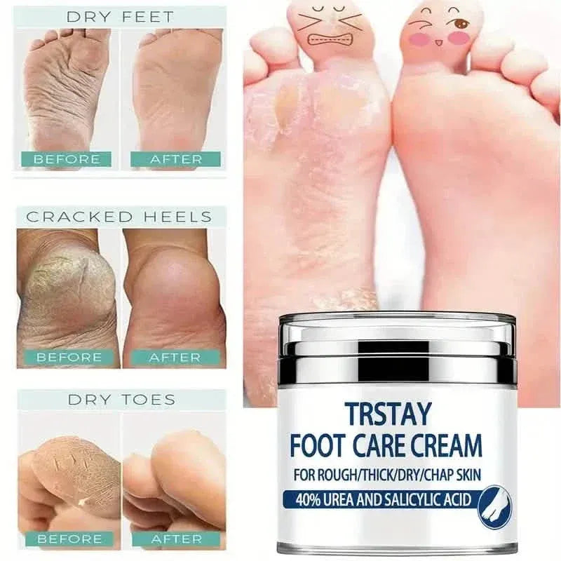 Trstay Foot Care Cream50g/ Foot Care Cream 40 Urea And Salicylic Acid - A-1 Thread Vault